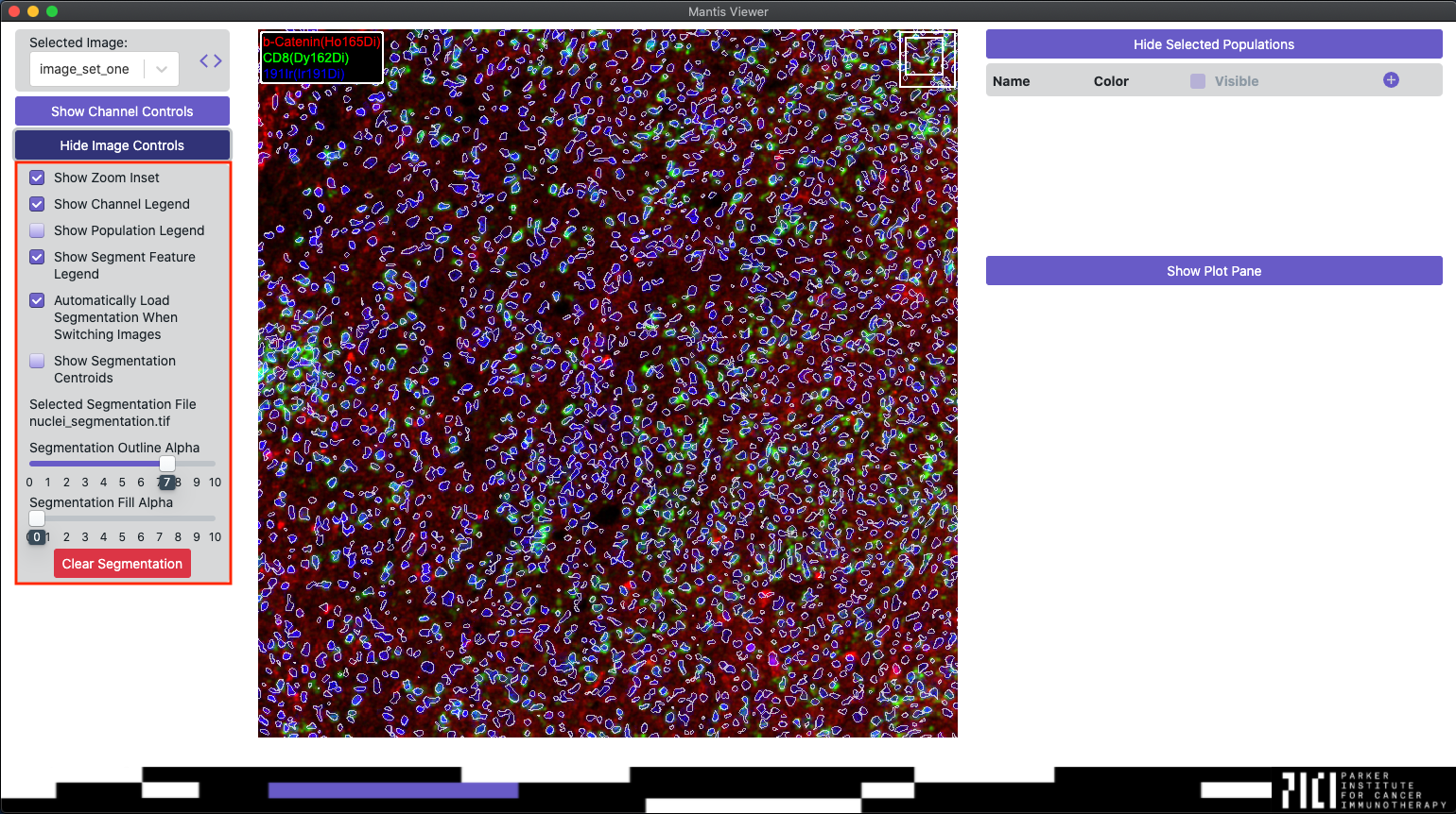 Segmentation Controls